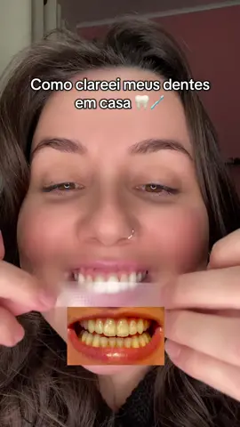#clareamentodental #fitadeclareamento #saudebucal #dentesbrancos 