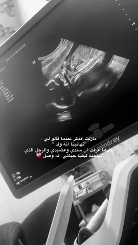 حوامل بيكم ولد لو بنوته 🥹🎀🩵؟؟ #اكسبلور #fypシ #ماشاء_الله #طفلي #حوامل_اي_شهر_صرتو_🤰🤰😍🦋 