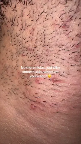 Your new secret weapon for flawless skin#electricrazor #trimmer #hairremoval #tiktokshopblackfriday #tiktokshopcreatorpicks 