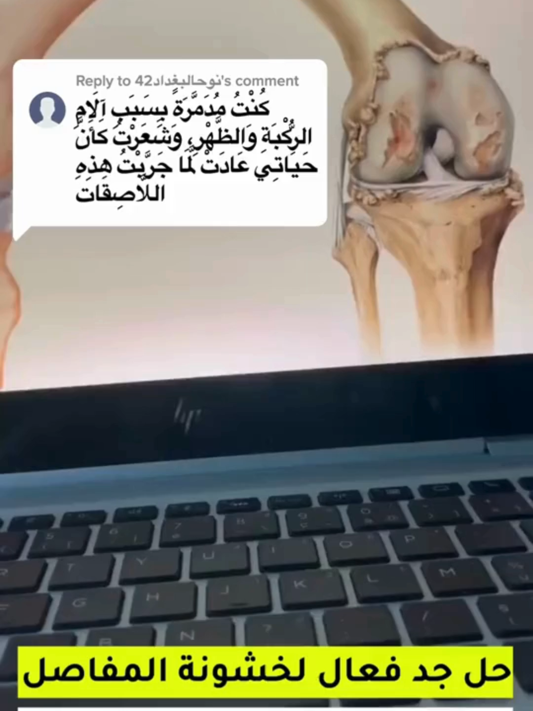 الكمية جد محدودة