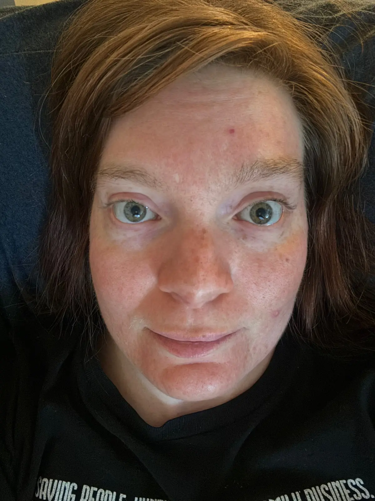 Got my first #clearandbrilliant laser treatment done at @LaserAway yesterday and today is day 2 of healing. Still red but no sand paper feeling yet and my face doesn’t feel tight or warm anymore.  Stay tuned! #nevadainfluencer #skincare #laseraway #laserfacialtreatments 