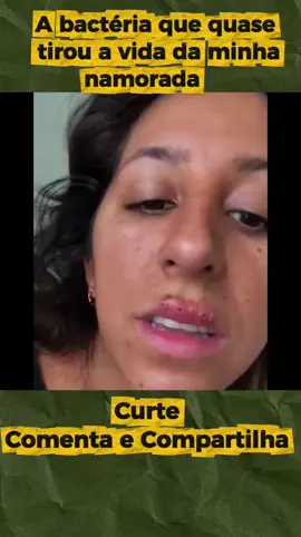 A bactéria que quase tirou a vida da minha namorada 😱 ​Ela reclamou a noite toda de dor na boca, o que descobrimos foi um pesadelo! ​A viagem para a fazenda acabou em EMERGÊNCIA no hospital! O que cresceu na boca dela Minha namorada passou a noite reclamando de uma dor estranha na boca. Decidimos ir ao hospital, mas o diagnóstico do médico me destruiu. Ela tinha uma bactéria muito agressiva e precisou de cirurgia de emergência. Orem por ela! 🙏 #Curiosidades #historiareal  #saude #fazenda 