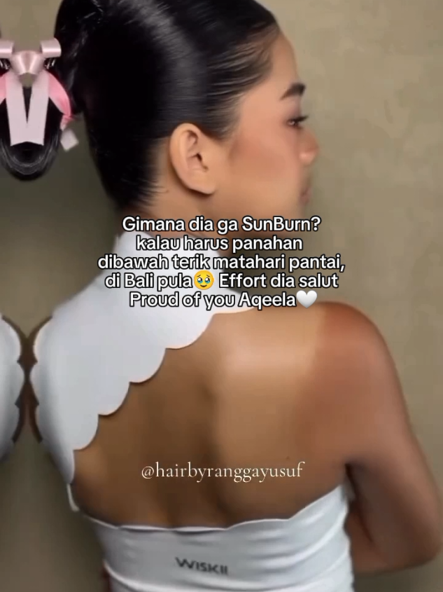 pasti sakit dan perih bgt yaa qeel?🥹 #aqeelacalista #aqeela #bali #sunburn #fyp 
