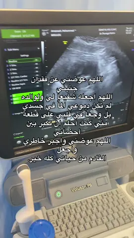 #اكسبلورexplore #الدمام_الخبر_الشرقيه 