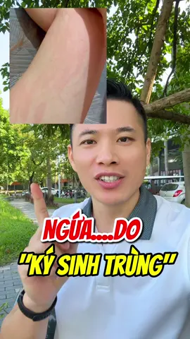 Ngứa do Ký Sinh Trùng nên #thaidocruot #sontotbung #Lamsachduongruot #kysinhtrung
