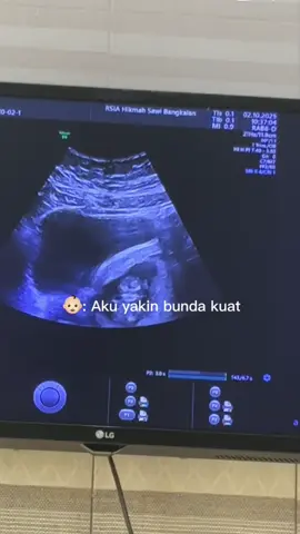 Masyaallah sehat sehat ya nak 👼🏻💝#masyaallahtabarakkallah #fyp #pregnant #bumilhappy #pejuanggarisdua 