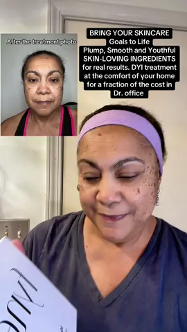 BRING YOUR SKINCARE Goals to Life Plump, Smooth and Youthful. 6 peptides Fade lines and wrinkles Helps fade and refine signs of visible lines and wrinkles Glowing Supports moisture retention Nourishes the skin barrier lasting firmness you can feel Reduce dark spots Aids to lighten post-acne marks Smooth out rough texture Boosts skin renewal Boost in firmness Supports the skin barrier. Are you looking to get those results listed above? Then I can tell you I found Fyne micro-infusion system. It will save you thousands of dollars with this do it yourself at home kit. A must try, different result may vary. Place your order today before their stock is depleted#serum #micro #infusion #24k #gold 