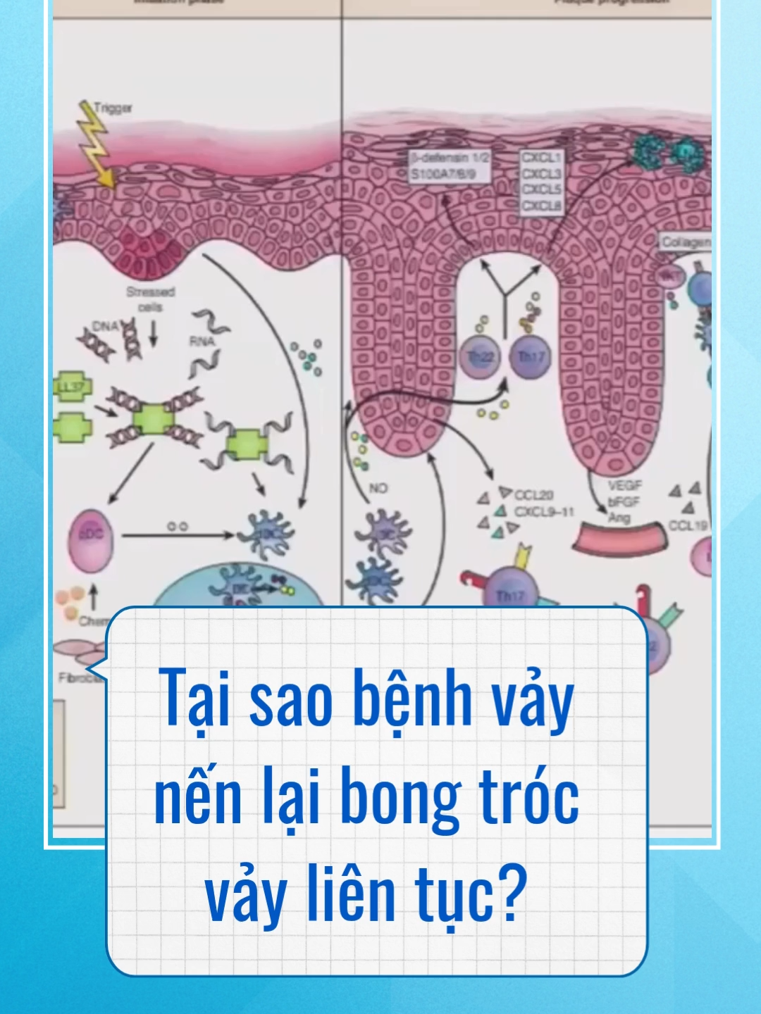 Tại sao bệnh vảy nến lại bong tróc vảy liên tục? #kimmienkhang #vaynen #vaynendadau #viemda #benhtumien #songkhoe