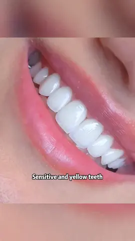 7XM Say goodbye to stains in days! #TeethWhitening #WhiteningToothpaste #YellowTeethFix #DentalCare #OralCare    