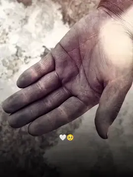 ရှိတော့ရှိတယ် ရှားတယ်😐