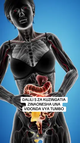 Usisubiri hadi utapike damu au uende hospitali ukiwa umeishiwa nguvu — dalili za vidonda vya tumbo huanza kimya kimya, lakini madhara yake ni makubwa mno ukizipuuza! 🚨 Hizi ndizo DALILI 5 za hatari zinazokuonyesha tayari una vidonda vya tumbo: 1️⃣ Maumivu makali au moto tumboni — hasa ukiwa hujala au baada ya kula. 2️⃣ Kichefuchefu, kukosa hamu ya kula, na tumbo kujaa gesi kila mara. 3️⃣ Kuhisi ladha chungu mdomoni — asidi inapopanda juu (acid reflux). 4️⃣ Kuharisha au choo kuwa na rangi nyeusi kama mkaa. 5️⃣ Kupungua uzito, uchovu wa mara kwa mara, na maumivu yanayokuamsha usiku. 💀 Ukipuuza: Vidonda hivi huendelea kukua, vinaweza kupasua utumbo, kuharibu ini, au kusababisha damu kutoka tumboni — hali ambayo ni hatari kwa maisha! Wengi huishia ICU kwa sababu walipuuzia maumivu ya kawaida ya tumbo. ✅  Ukiona dalili hizi, usijidanganye ni “gas” au “chumvi nyingi kwenye chakula.” Tafuta tiba sahihi mapema kabla havijawa sugu. Wasiliana na Dr. Simon Healthy Clinic kwa tiba kamili ya kuondoa vidonda vya tumbo na kurejesha afya yako ya mmeng’enyo wa chakula. 📞 +255 714 061 511 👉 Vidonda haviponi kwa dawa za maumivu — vinatibiwa kwa suluhisho sahihi!#usa#usa#