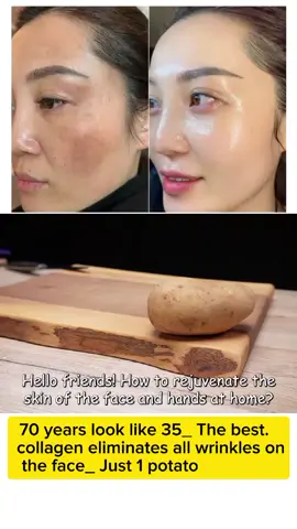 70 years look like 35_ The best collagen eliminates all wrinkles on the face_ Just 1 potato#wrinkles #skincareroutine #skinwrinkles #recipes #beauty 