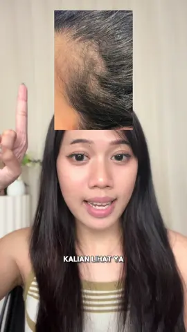 Sengaruh itu sama rambut aku  #Akarayu #AkarAyuMu #SehatDariAkar 