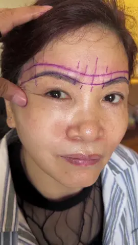 眉综合术前设计 #眉综合 #变美 #除皱