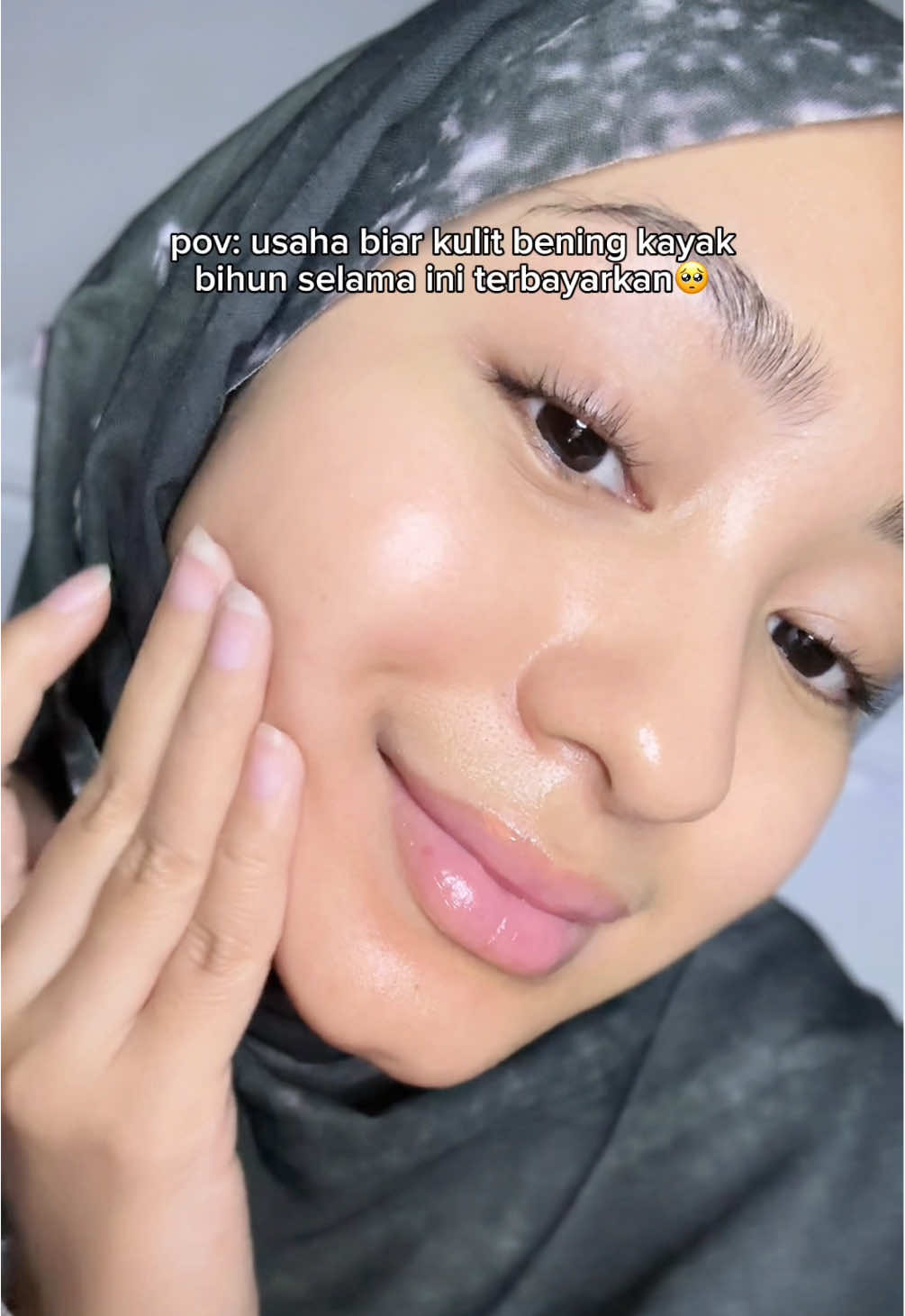 usaha yang super terbayarkan🥺🫶🏻 #retinol #skincareroutine 