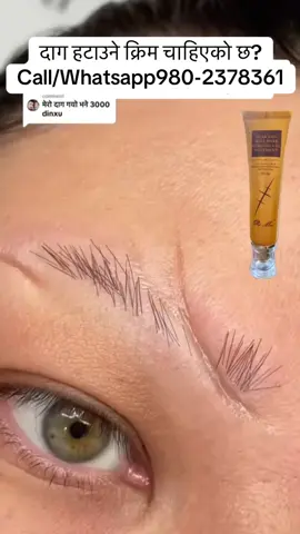 #foryoupage #musergeneretion #viralvideo #tiktok #scar 