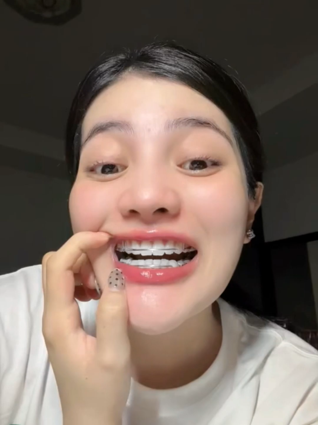 ฟันดำแค่ไหนก็ไม่กลัว#ยาสีฟัน#ฟันขาว