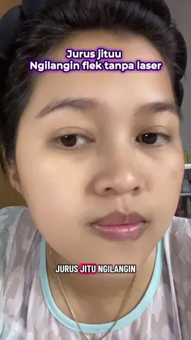 Jurus andalanku cuma pakai ini toner merah #toner #tonerviral #tonerflekhitam #yonglowskincare 