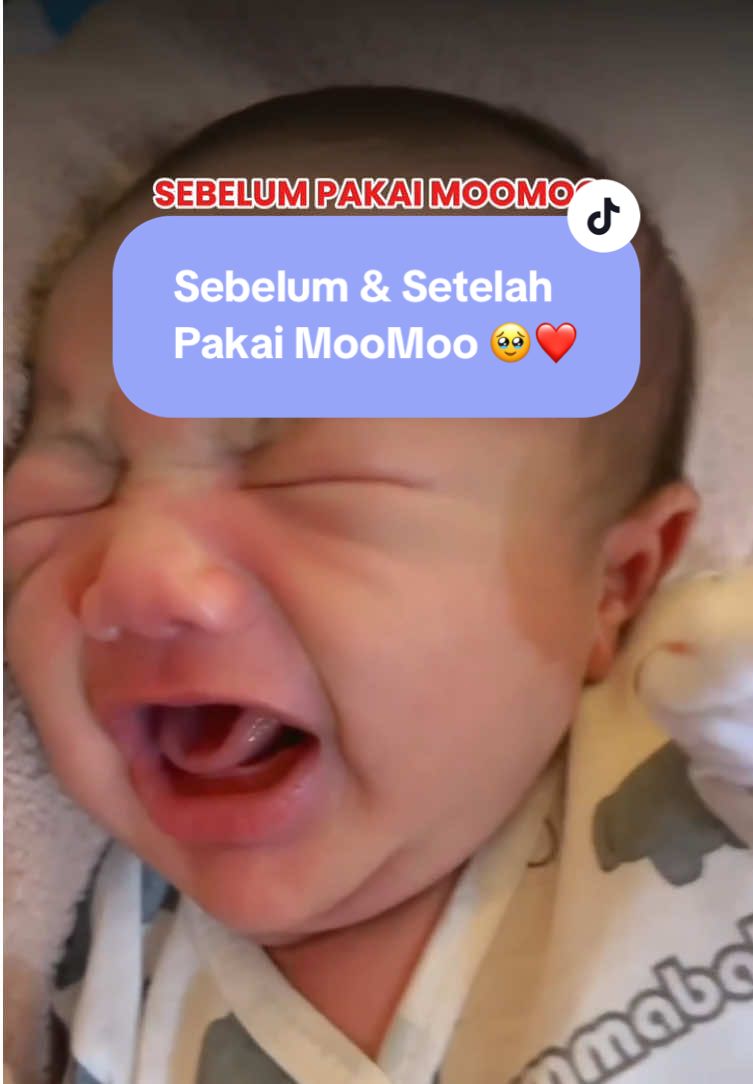 Before vs After pakai MooMoo 🥹 Kerasa banget bedanya pakai MooMoo bayi gak rewel lagi, minum susu jadi banyak, dan mama tetep bisa DBF soalnya gak bikin bingput 🥰❤️ #botolsusumoomoo #botolmoomoo #dotbayi #busui #newborn 