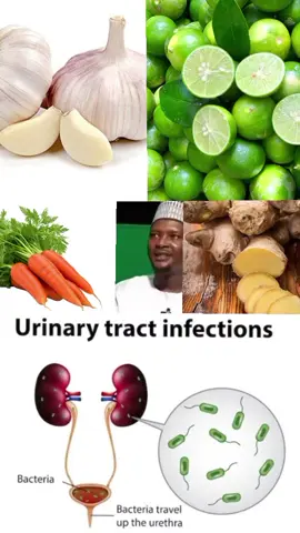 @ALMALEEK_HERBAL_MEDICINE🌿💊 @Dr Sultan katsina @ALMALEEK ISLAMIC MEDICINE 💊 @MD_HASKE_COMMUNICATION @dr Khaleepha Herbal medicine #foryoupep #harbal #fygpシ #maradiniger🇳🇪 #codevoire🇨🇮lemon 
