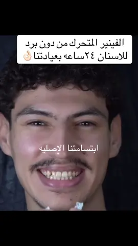 لدينا عيادات بجميع انحاء المملكة🇸🇦🇸🇦 لعمل المقاسات نحن مرخصين وموثقين انتبهو من اعلانات الغش التجاري وخاصة اعلانات السناب شات بشراءابتسامه من دون مقاس والحضور للعياده ❌❌