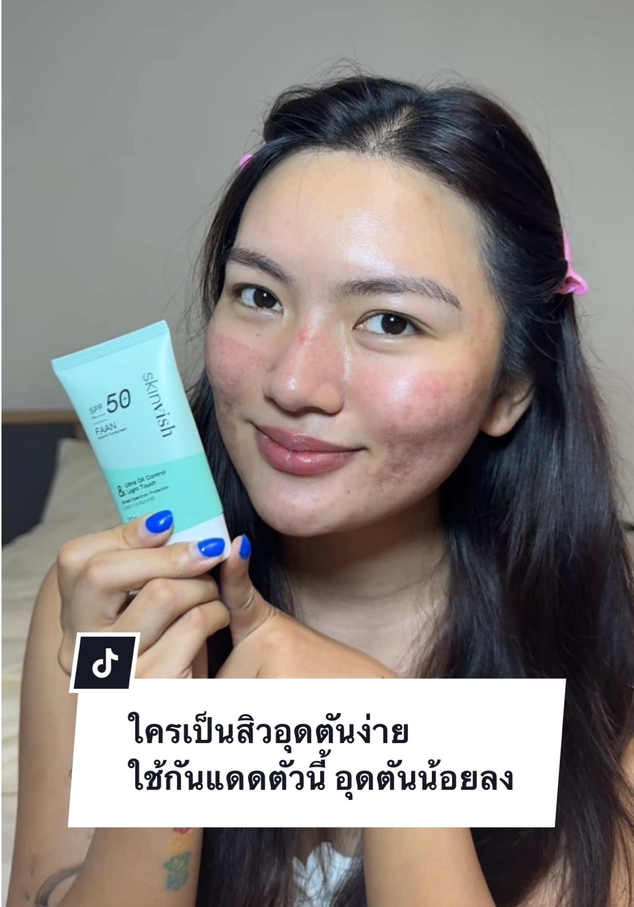 กันแดดที่เบาผิว คุมมัน ไม่อุดตันเพิ่ม #skinvish #กันแดด 