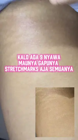 I'm so happy bye-bye kulit macan 💃🏼  #stretchmarks #stretchmark #stretchmarkserum #stretchmarkoil #ciaraindonesia 