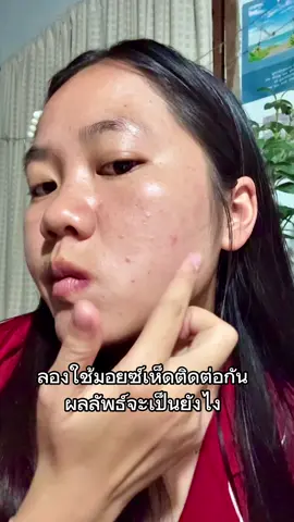 ลองใช้มอยส์ในเซเว่น5วัน✨#ผักขม #บิตตี้  