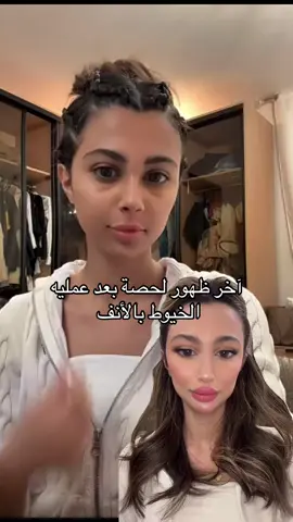 #اكسبلور #حصة #fyp #foryoupage 