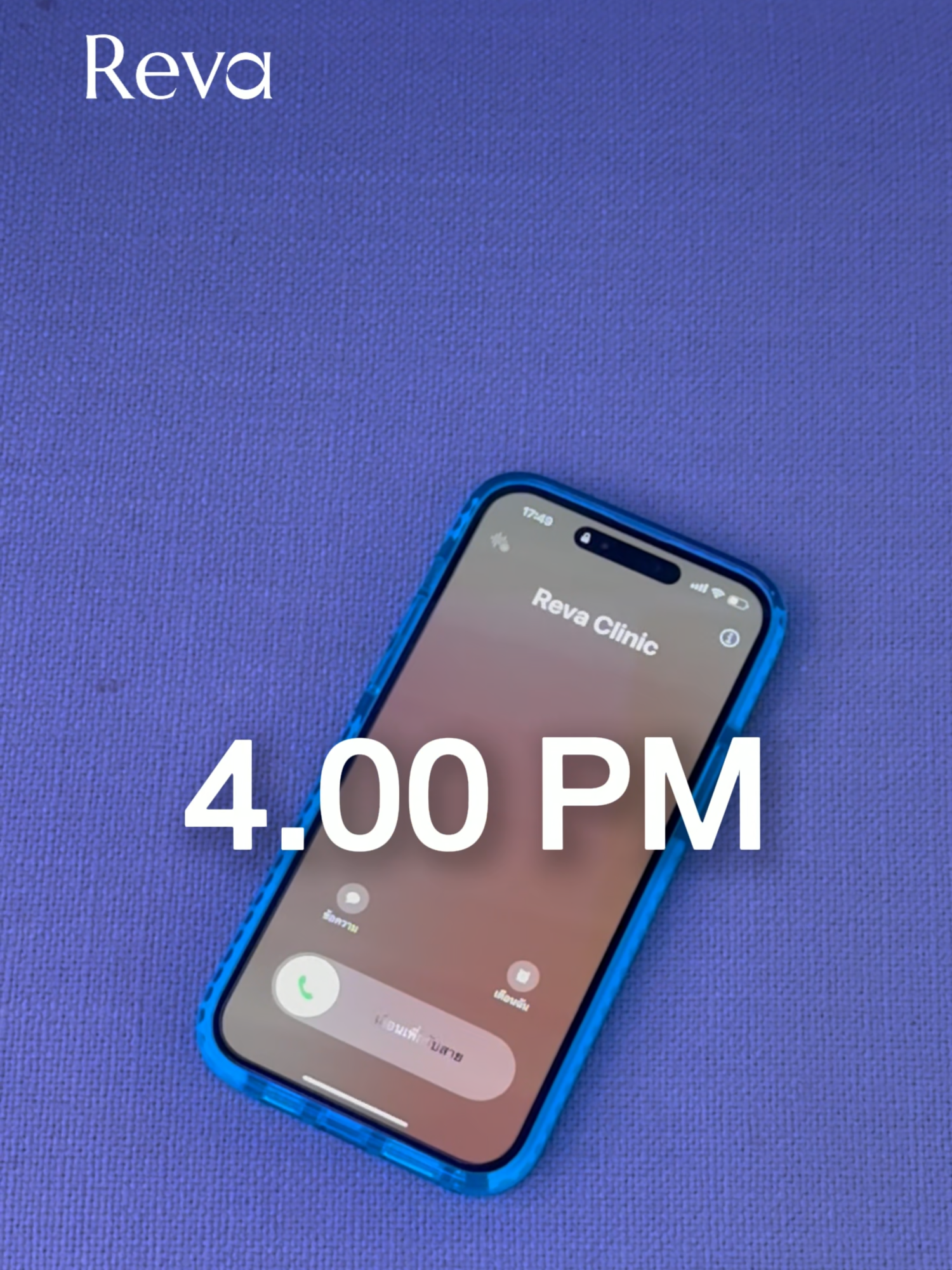 หน้ายกแก้มยุบ #revaclinic #รีว่าคลีนิค #programoligio #ยกกระชับใบหน้า