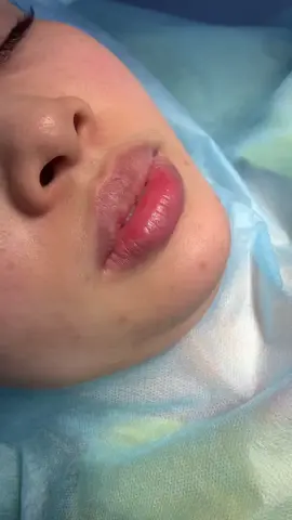 Cut môi đẹp tự nhiên #TikTokAwardsVN #catmoidep #catmidep #catmoi #catmoitunhien 