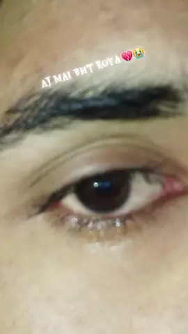 Tara Bina Asi pagal pagal hoja ga yara#eyesvideo #sadstory #😭😭😭 #foryou #1millionaudition 