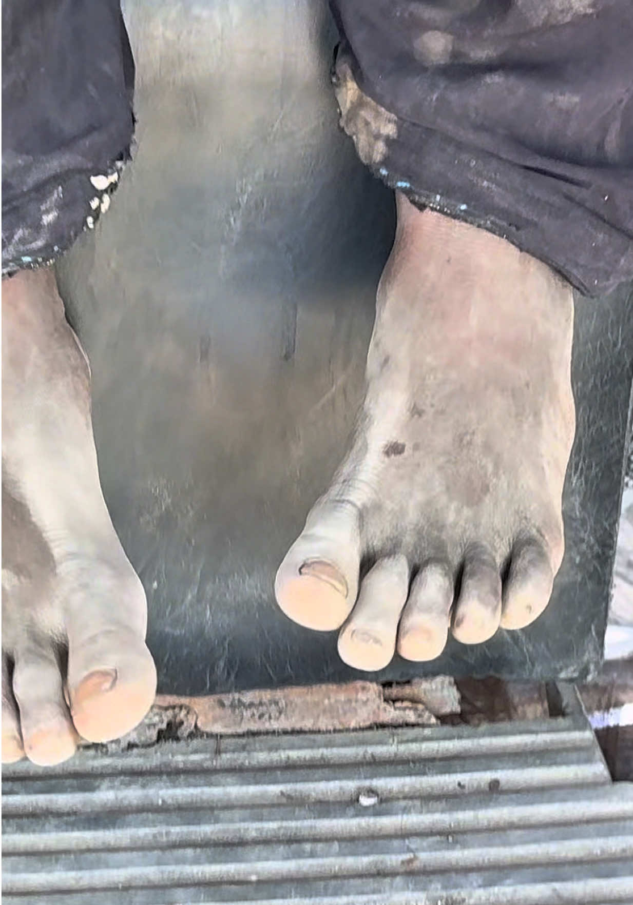 Insane, Hungry, Homeless Boy Rescue | Before and After Transformation part 2 #asmr #asmrsounds #haircut #❤️❤️❤️ #viralvideos 