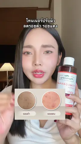 #รีวิวบิวตี้ #tiktokป้ายยา #โทนเนอร์ #plantnery #รอยสิว 