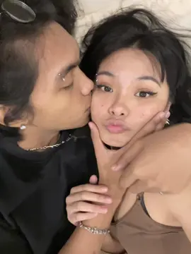 kaya nag kaka pimples e😭😂
