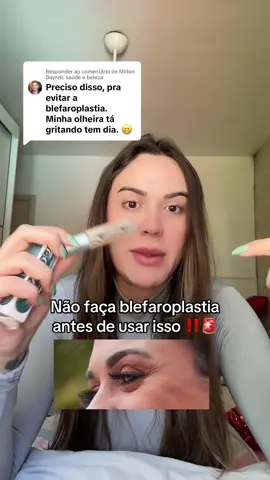 Respondendo a @Milton Dayrell: saúde e beleza  Depois me agradeçam!  #olheirasescuras #blefaroplastia #linhasfinas #rugas 
