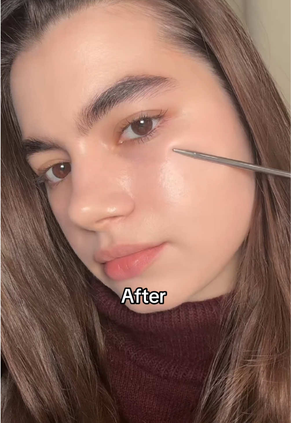 retinal is life changing 🫶🏻 #celimax #skincare #retinal #clearskin #acnefree 