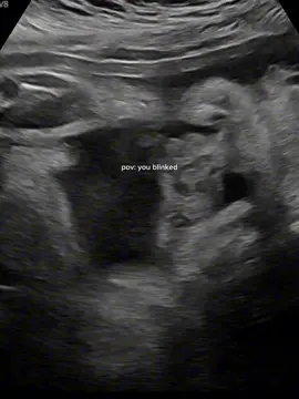 can’t believe I’m a mom 🥲💗 #ftm #newborn #CapCut #firsttimemom #mom 