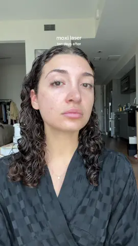 ok love this treatment!! helped my pores so so much and barely any downtime! @skin pharm #skinpharm #moxilaser @Natalie FNP-C 