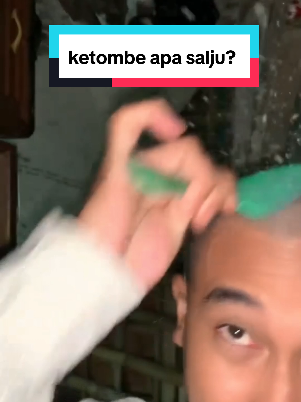 tag temen kalian yang ketombenya kayak gini #ketombe #sampoantiketombe #ketombeparah 