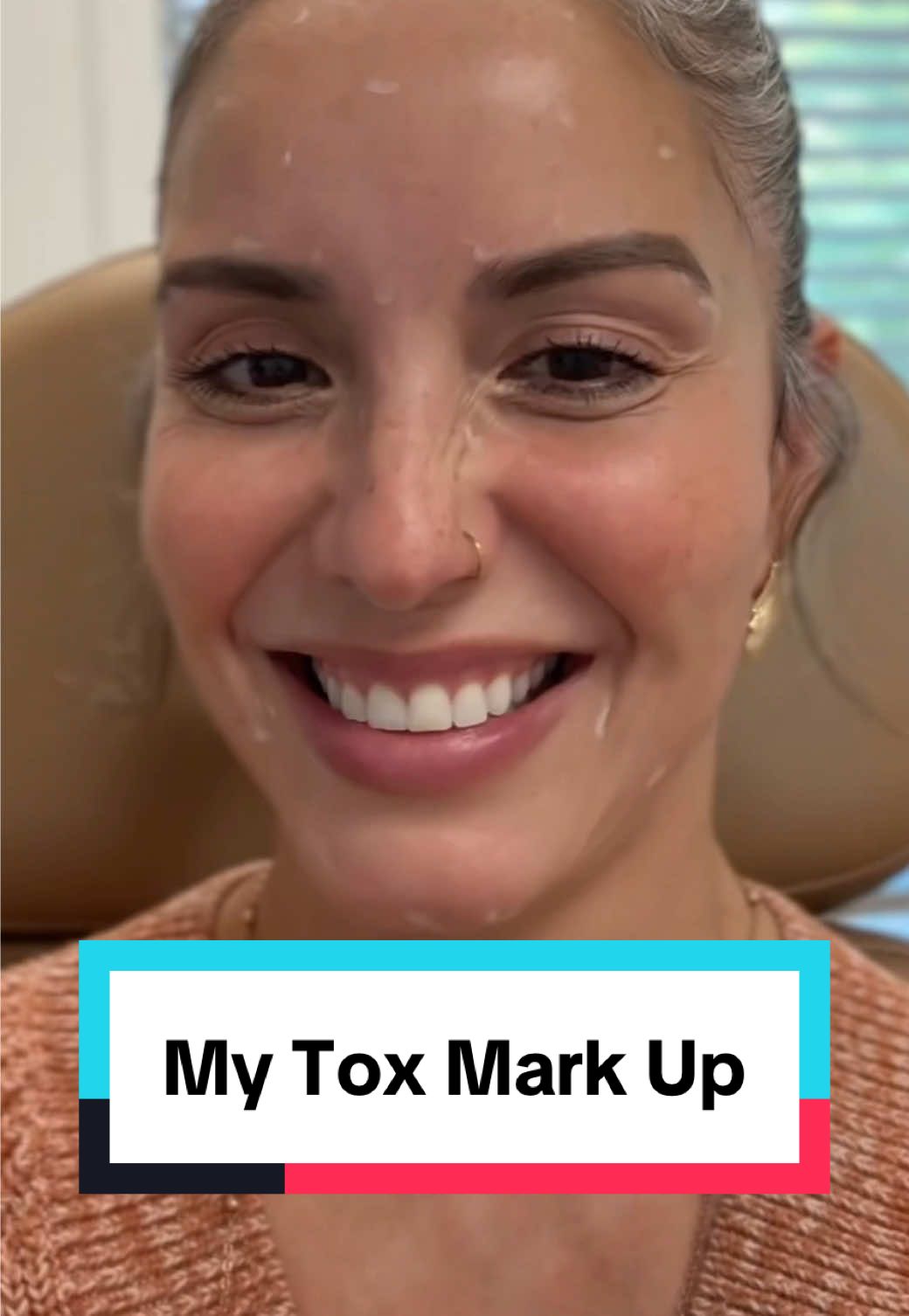 40 units of Botox 💉 with Emily Meyer’s, FNP-C, LE at @SkinTherapeutics — sharing my experience & what the marking process looks like before treatment. This isn’t medical advice — always consult a licensed injector to find what’s right for you. #botox #matureskin #medspa #neurotoxin #midlifeconfidence 