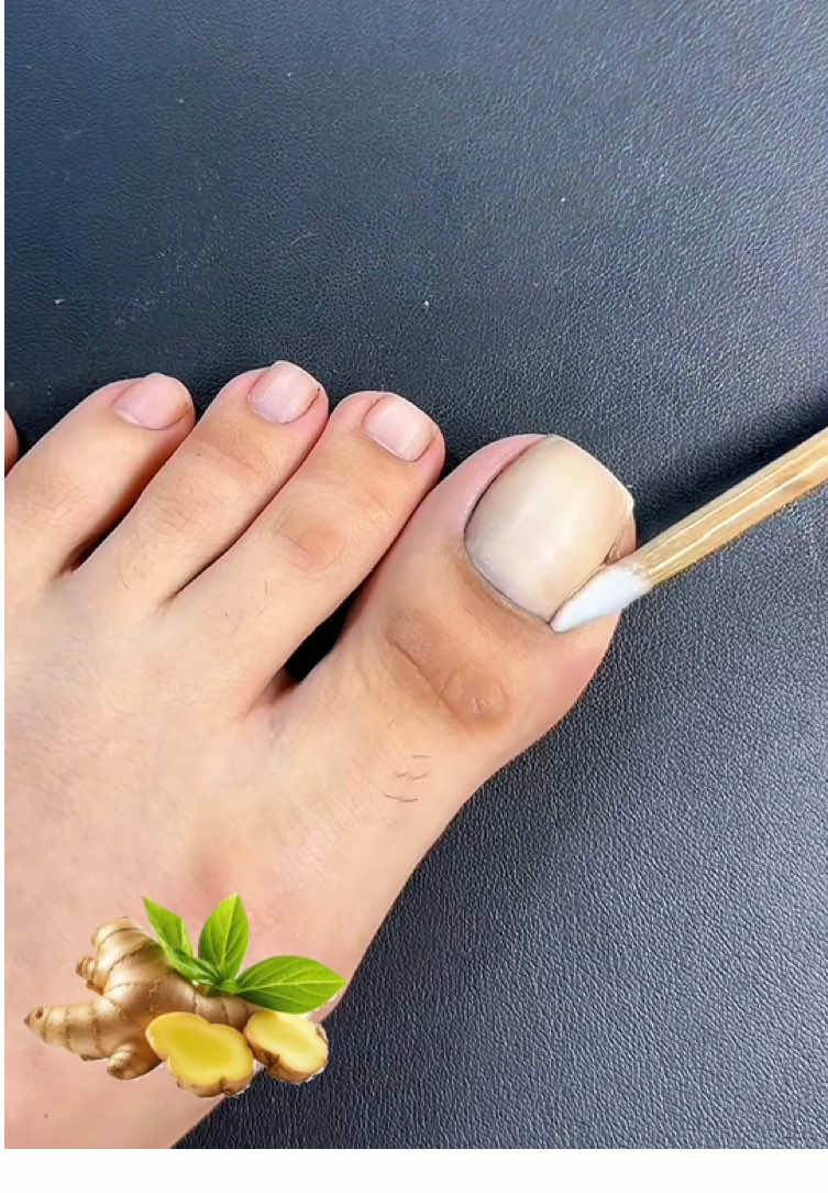🍄💅🏼¡Revitaliza tus uñas con nuestro Aceite Esencial de Jengibre! 🫚 Este aceite fortalecedor, enriquecido con vitaminas del complejo B y extractos botánicos, está diseñado para reparar y fortalecer las uñas dañadas. #HAIYUE #viraltiktok #fyp #catrinachallengetiktokshop #uñaslindas #hongos #cuidado 1020