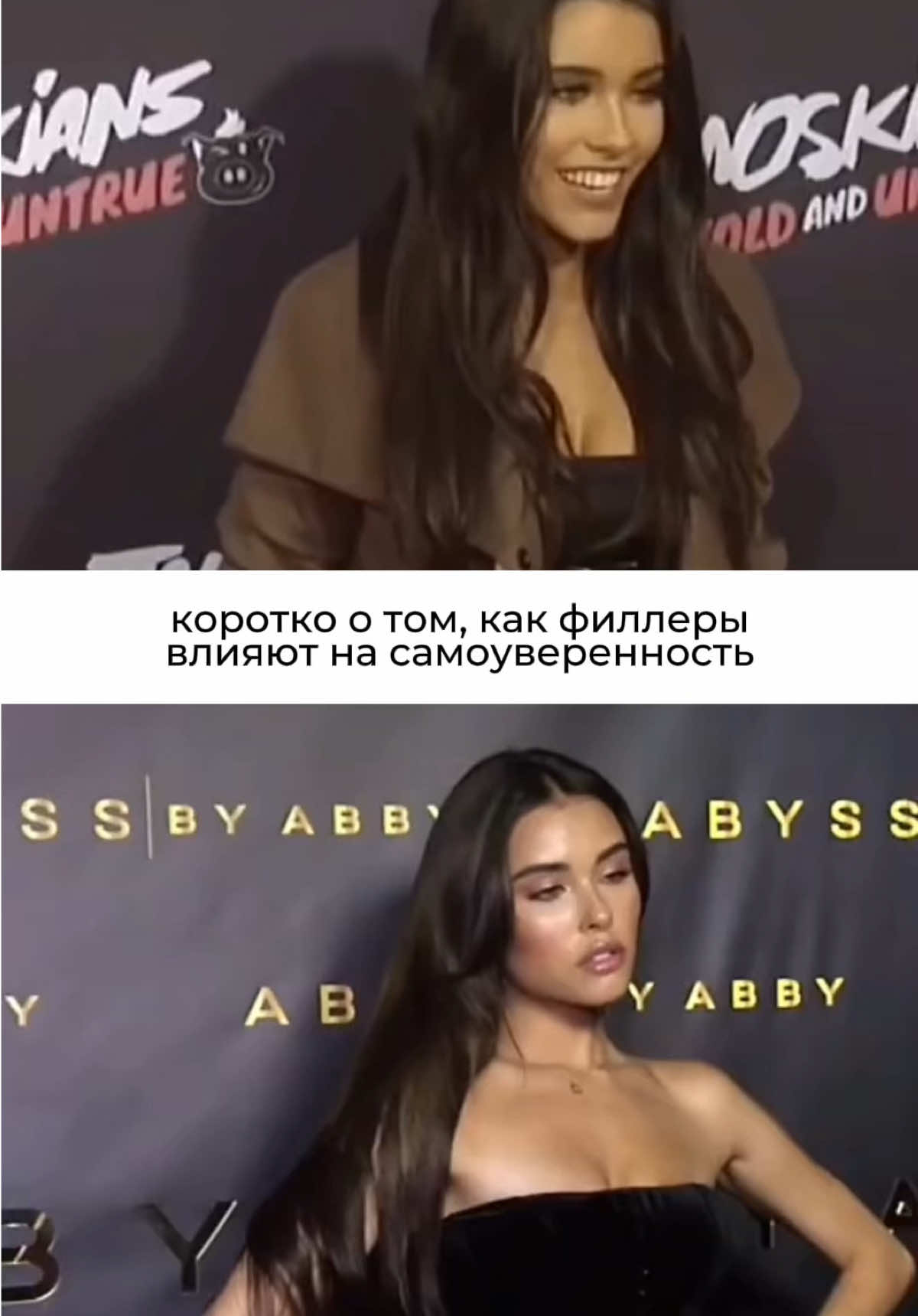 обожаю, когда косметология подчеркивает, а не меняет полностью🪽