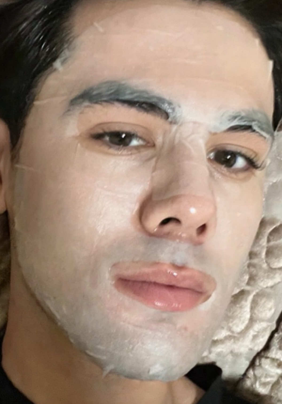 🧴 Differin — retinoid kuchi bilan ajin va aknega qarshi! Ko‘pchilik uni “ugrilar uchun krem” deb biladi, lekin aslida Differin (adapalene 0.1%) — bu retinoid oilasiga mansub faol modda. U terining yangilanishini tezlashtiradi, toshmalarni kamaytiradi va pigment dog‘larni ochadi. Natija? Yaltiroq emas, silliq va tiniq teri! 📌 Ishlatish: kechqurun, toza va quruq teriga yupqa surtib chiqing. 🕐 Dastlab 2–3 marta haftasiga, so‘ng har kuni. ⚠️ SPF bilan birga ishlating — bu juda muhim!  . . #uzbek #uzbekiston #uzbekiston🇺🇿 #tashkent🇺🇿 #uzbekistan 