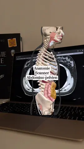 Scanner AP : ⚠️les structure anatomiques s’affiche en bleue sur les schémas au dessus. Étudiant manip Rx  #fyp #pourtoi #manip #medecine #santé #ifsi #muslim #radiologie #anatomy 