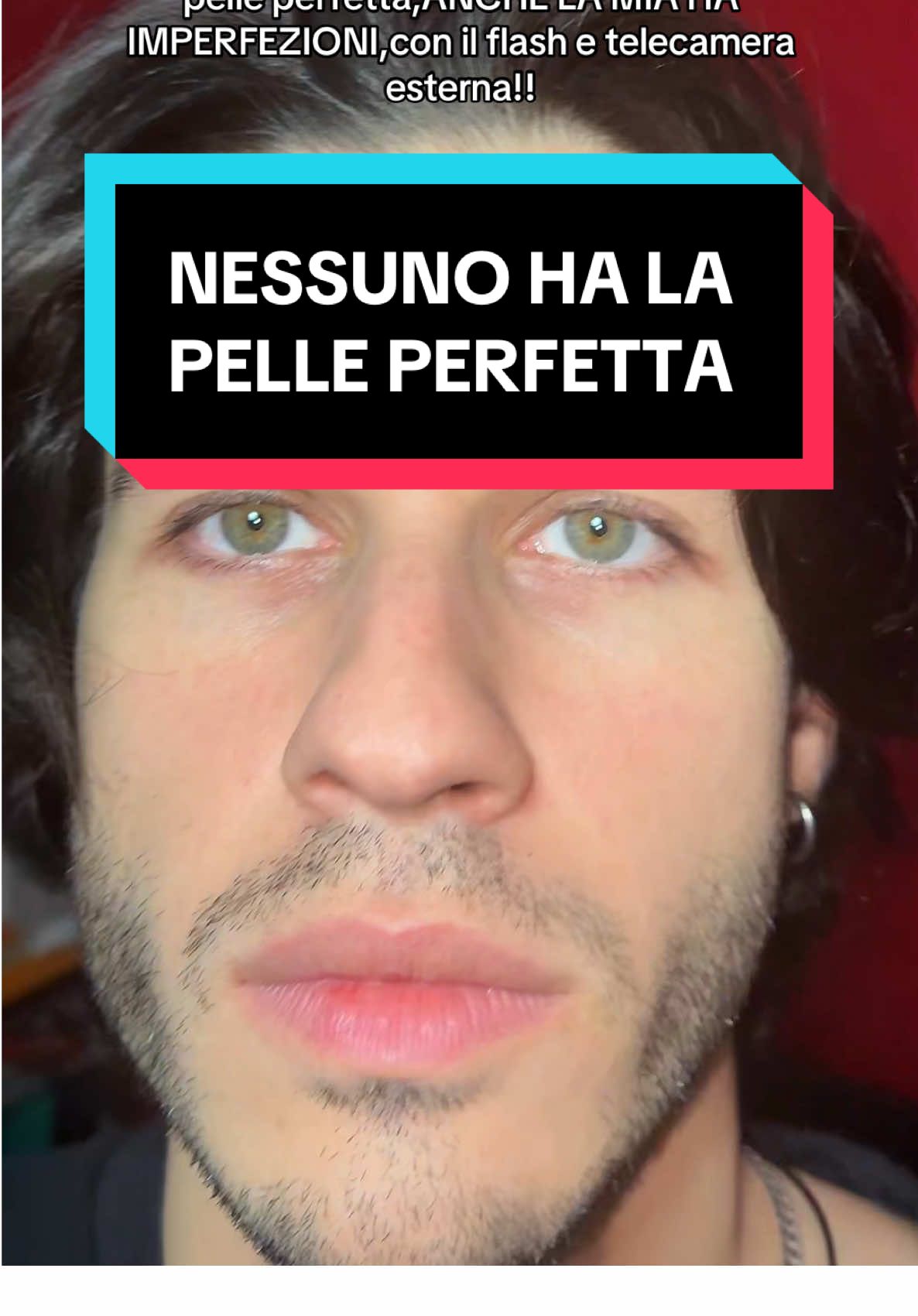 Nessuno ha la pelle perfetta!! #looksmax #looksmaxing #pelle #skincare #GlowUp 