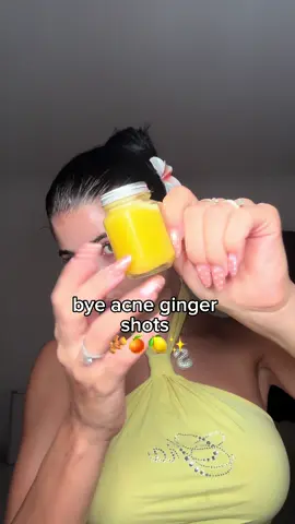 bye acne ginger shots 🫚🍊🍋✨  #ginger #shot #skincare #acnefighting 
