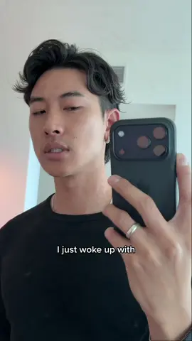 when the doctor told me what’s wrong with my skin… 😮‍💨 