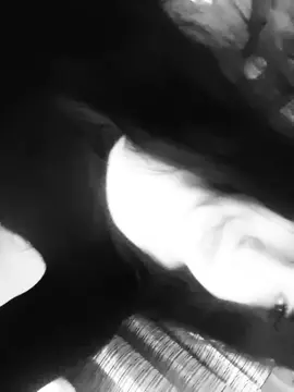 🙈✨️