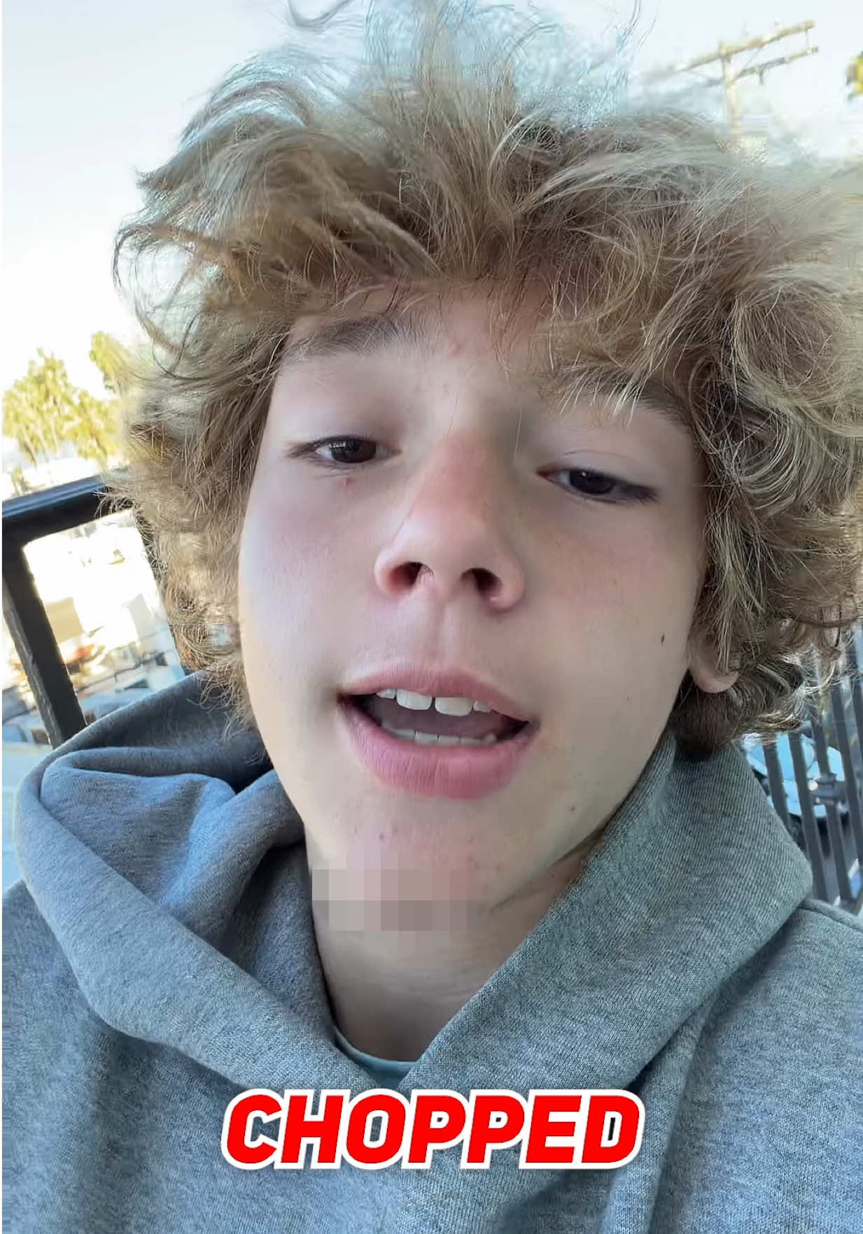 Do You Think The 67 Kid Will Make A Full Recovery? #67kid #67kidinjury #h00pify 